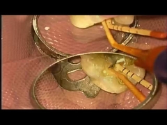 SANI TREATMENT CAUSA